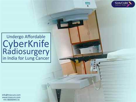 Undergo Affordable CyberKnife Radiosurgery for Your Lung Cancer Treatment in India